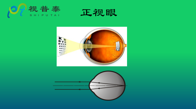 眼鏡光學(xué)知識(shí)
