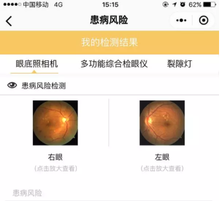 星創(chuàng)視界聯(lián)手春雨醫(yī)生，眼鏡店或成在線問診大入口