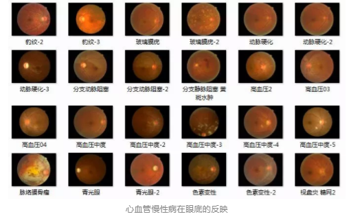 視光變革者寶島眼鏡CEO王智民：AI是慢性病、近視防控救星