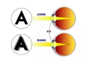 東莞驗(yàn)光師考證培訓(xùn)散光如何正確應(yīng)對(duì)？