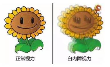 央視《健康之路》：你知道嗎？老花眼視力變好，有可能是患了白內(nèi)障